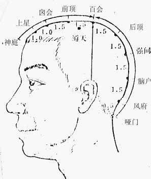 上星穴|醫砭 » 經穴庫 » 上星